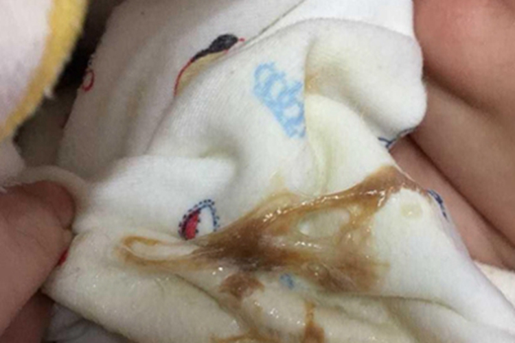 婴儿消化道出血吐奶图