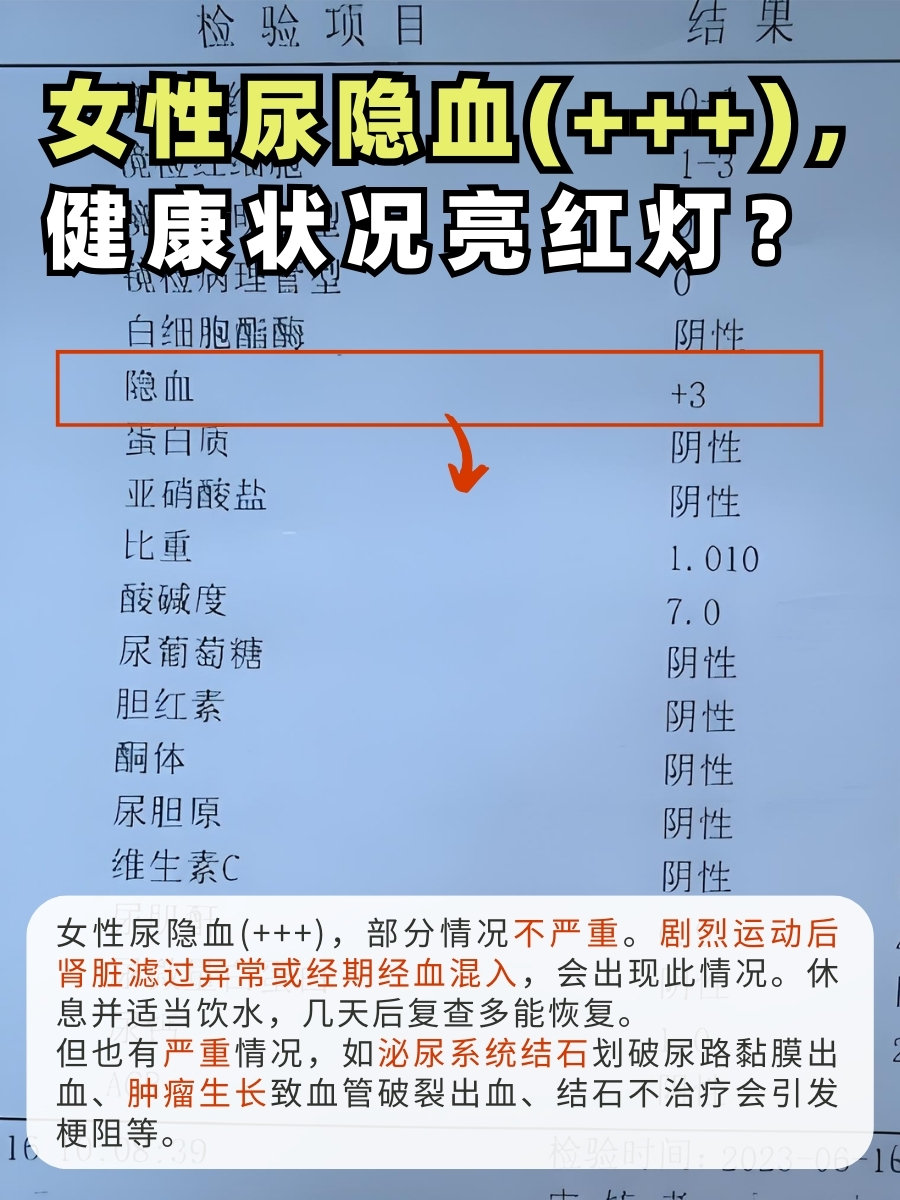 女性尿隐血(+++),健康状况亮红灯?
