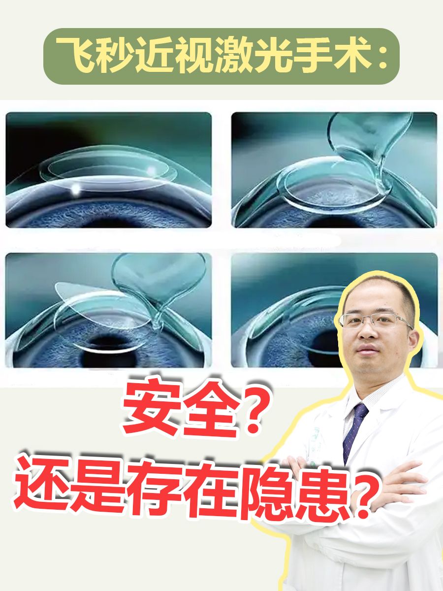 飞秒近视激光手术:安全?还是存在隐患?