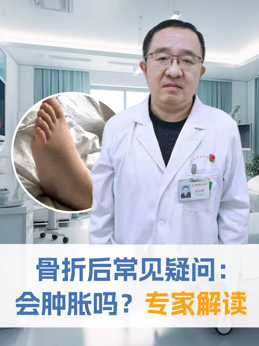 骨折后常见疑问：会肿胀吗？专家解读