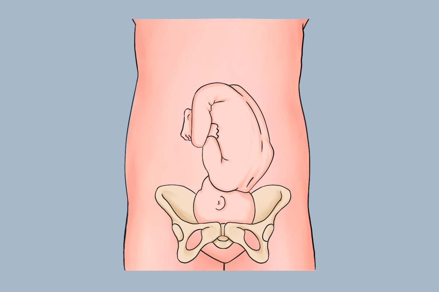 正枕前位是什么胎位图片_有来医生