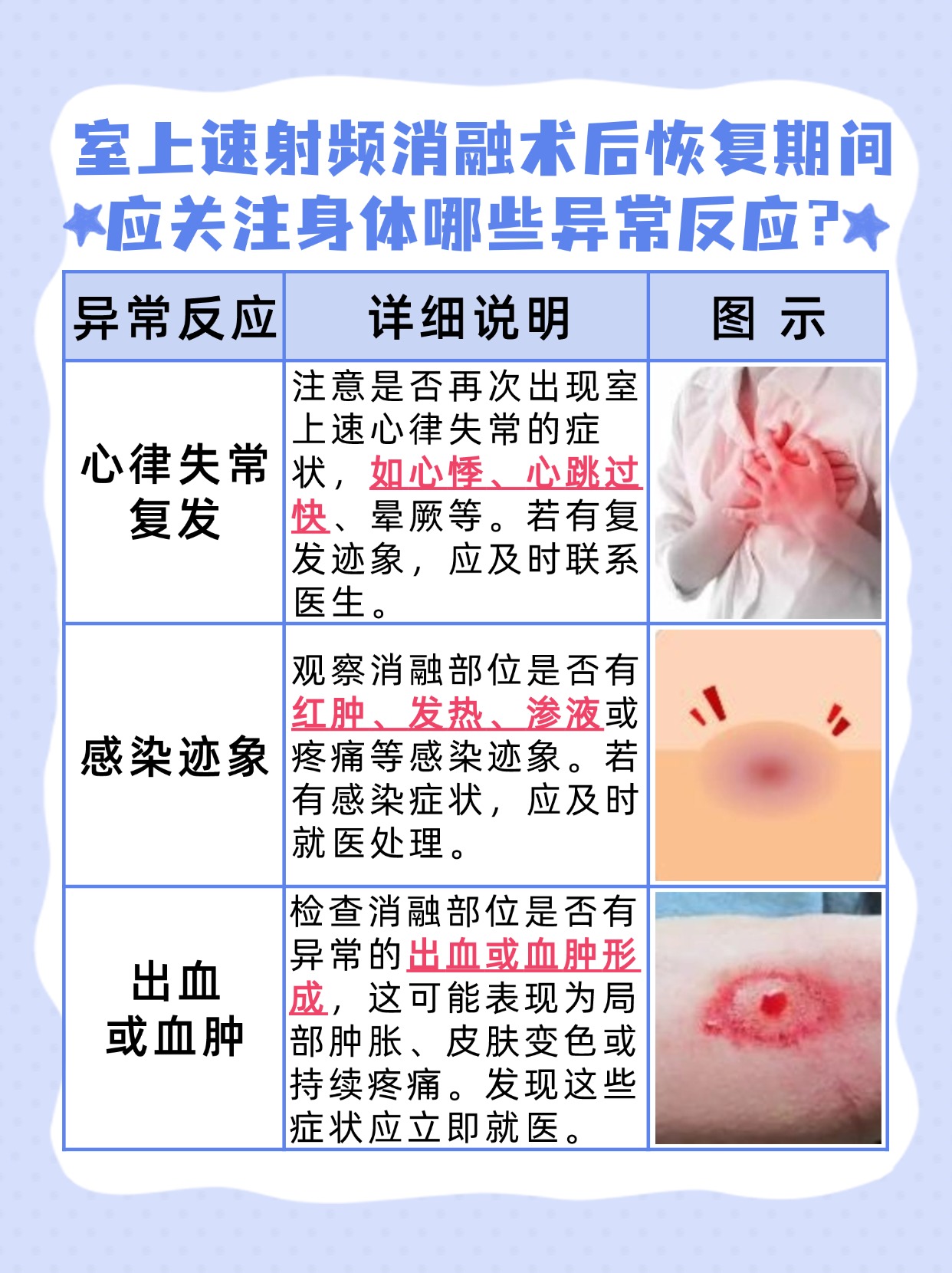 带你了解—室上速射频消融术后恢复需要的时间