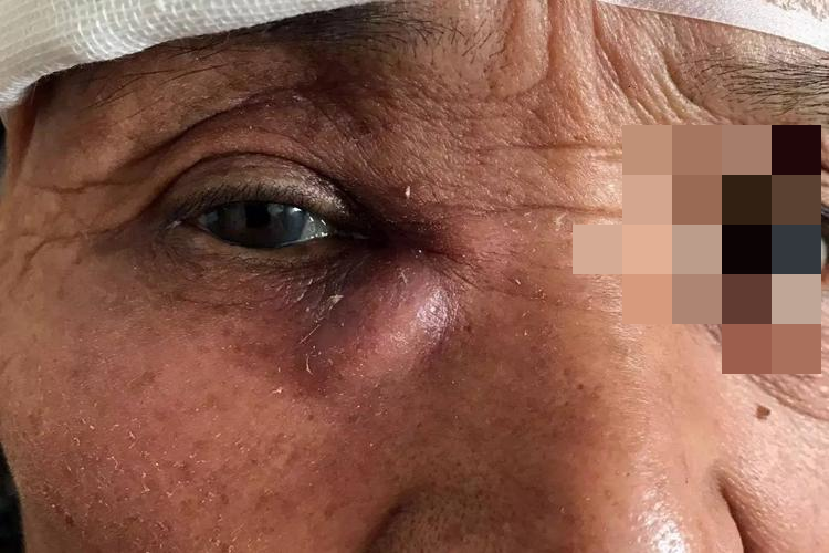 本文由有来医生原创,经专业医师审核校对