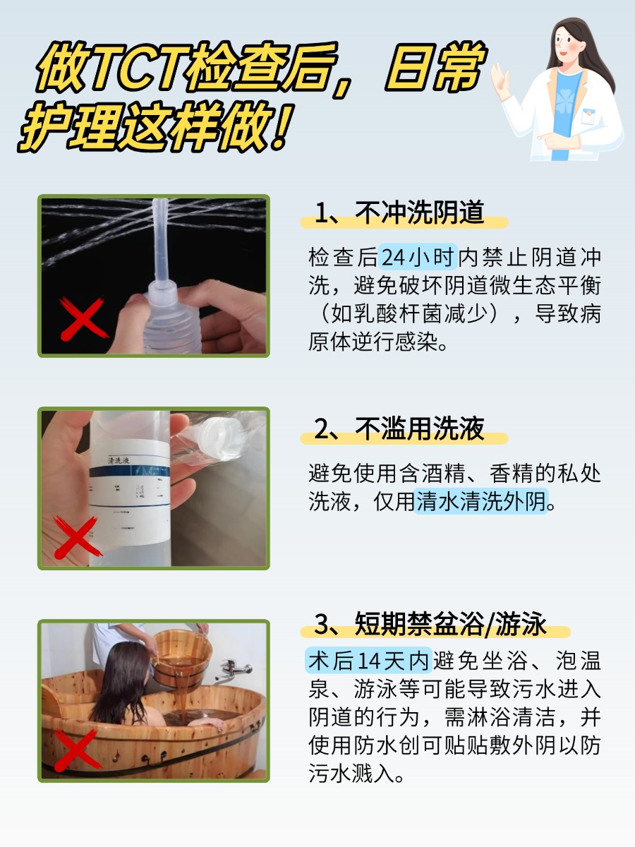 TCT 检查什么项目?妇科医生带你看懂