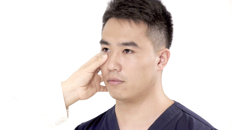 按摩眼周穴位.gif
