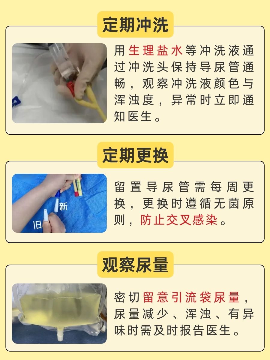 新手必看！三腔导尿管三个端口区分法