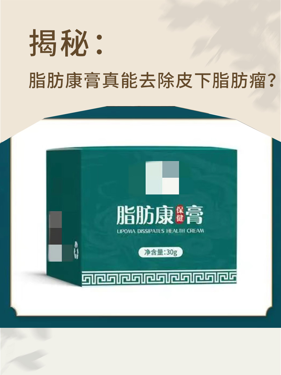 揭秘：脂肪康膏真能去除皮下脂肪瘤？