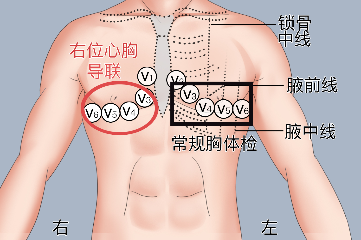 右位心胸导联图