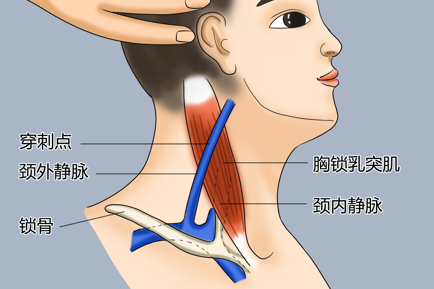 颈静脉穿刺位置图片