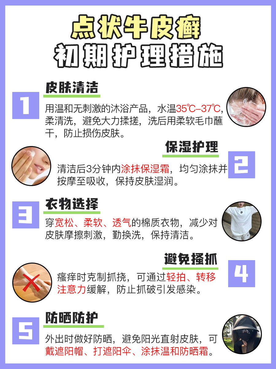 点状牛皮癣初期模样,速来围观!