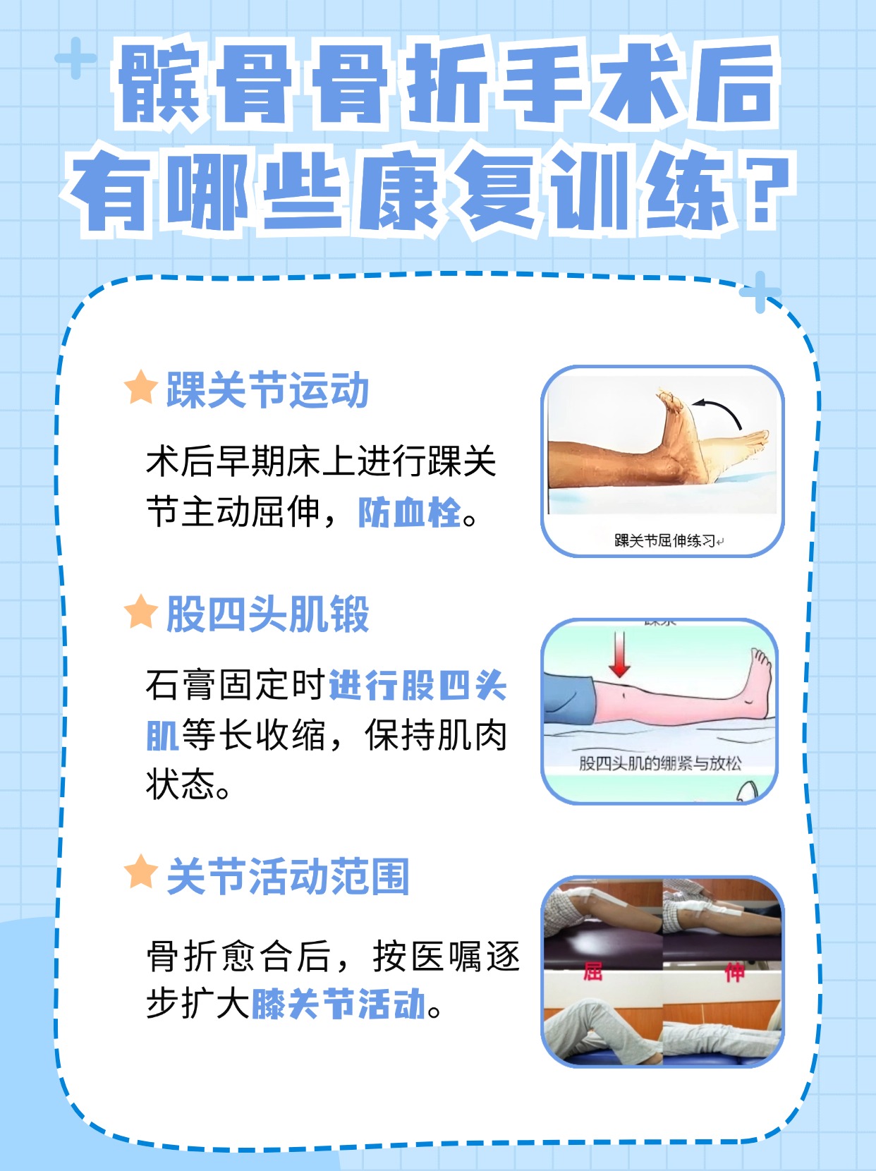 髌骨骨折手术后康复训练步骤图