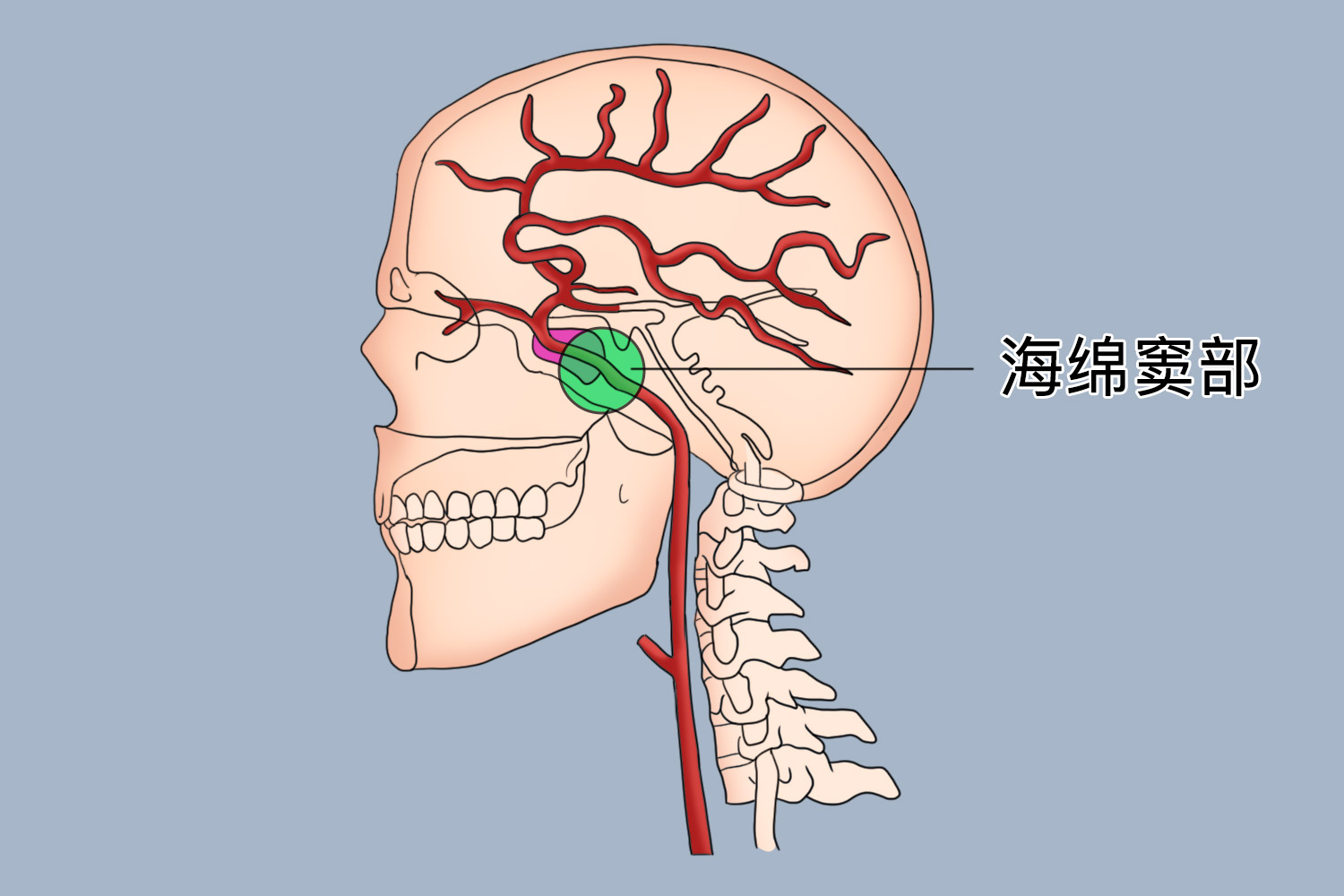 颈内动脉海绵窦部图