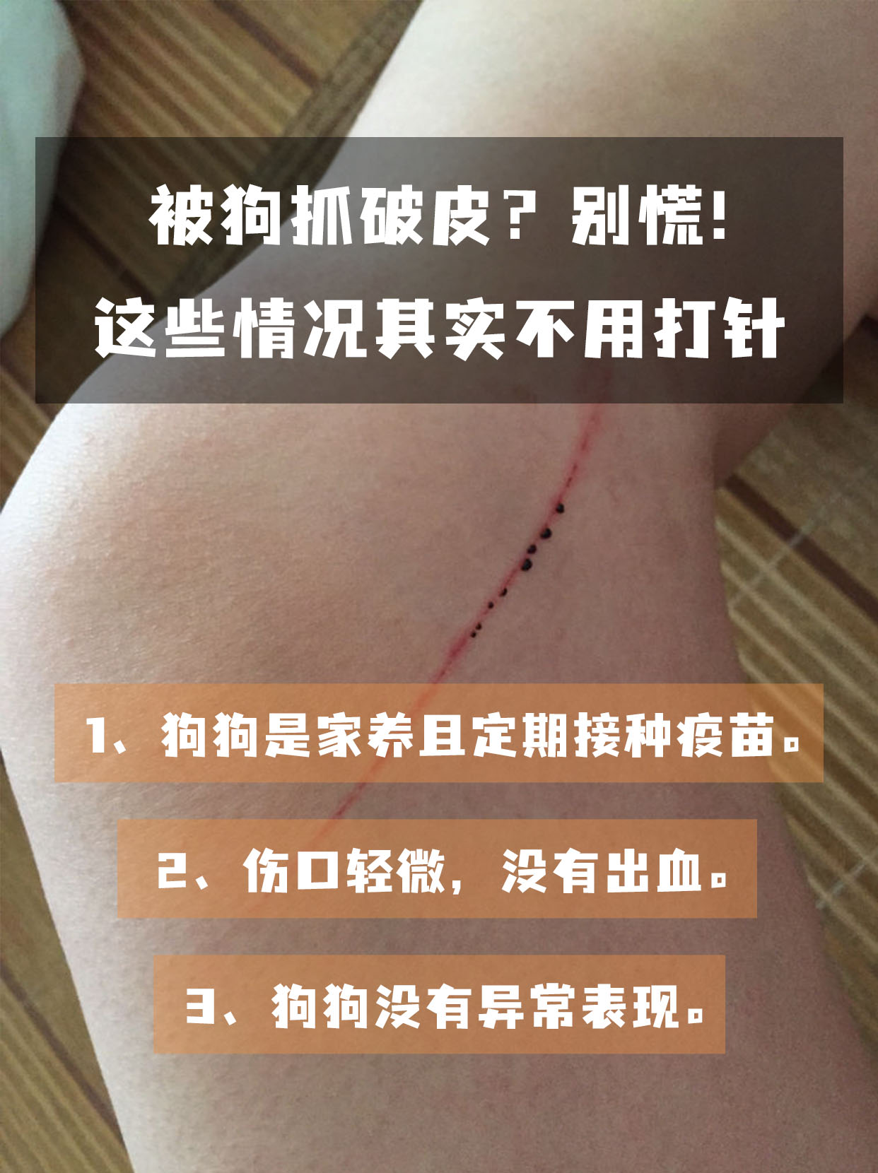 被狗抓破皮？别慌！这些情况其实不用打针