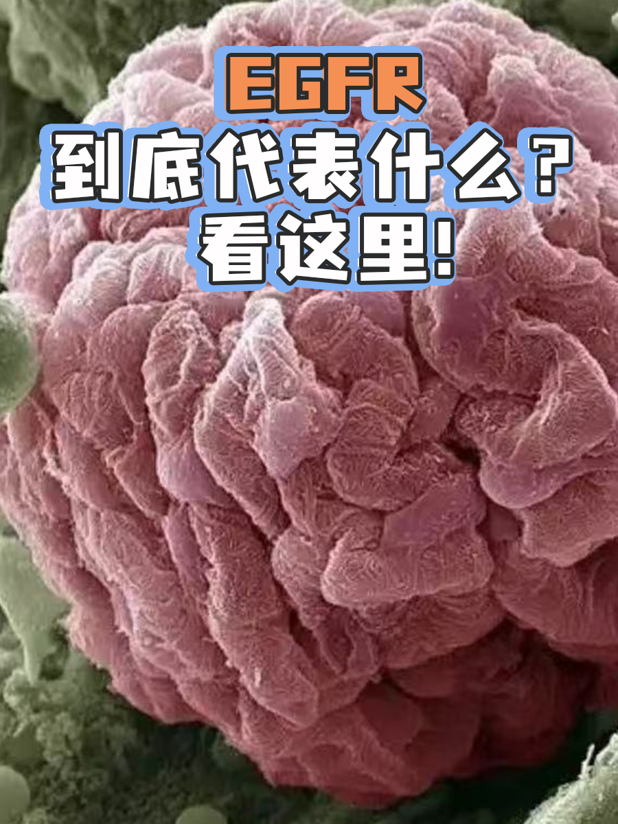 EGFR到底代表什么？看这里！