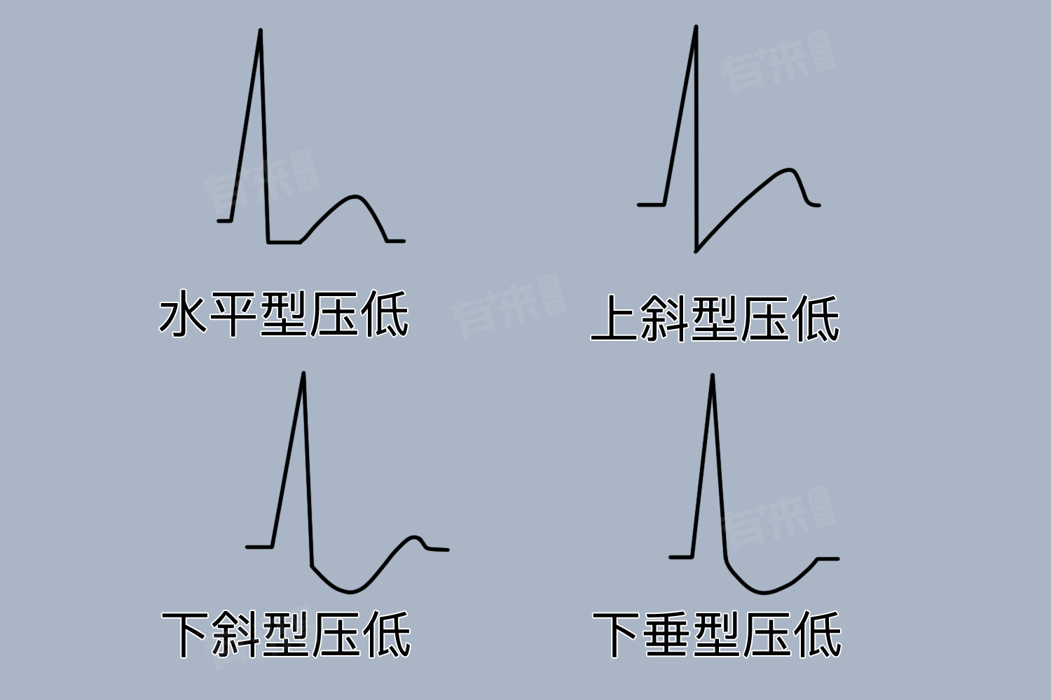 部分导联st-t改变是什么意思-有来医生