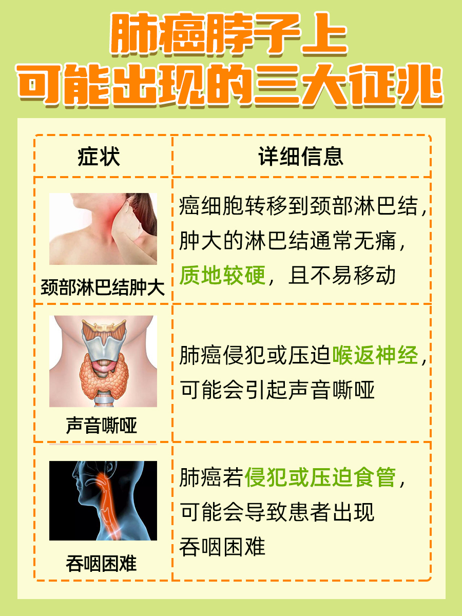 肺癌颈部三大预警信号:早识别,早治疗