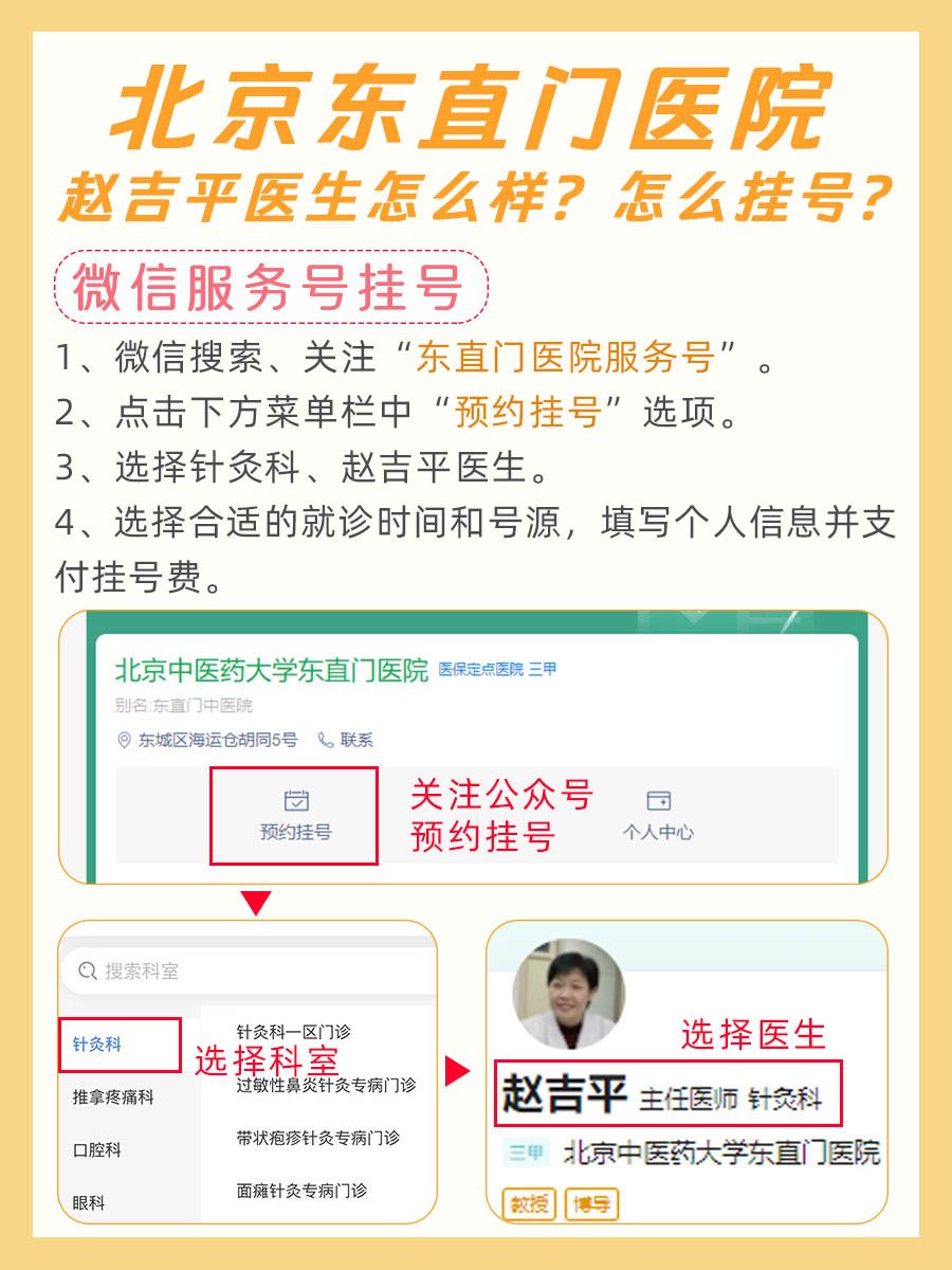 北京东直门医院赵吉平医生怎么样?怎么挂号?