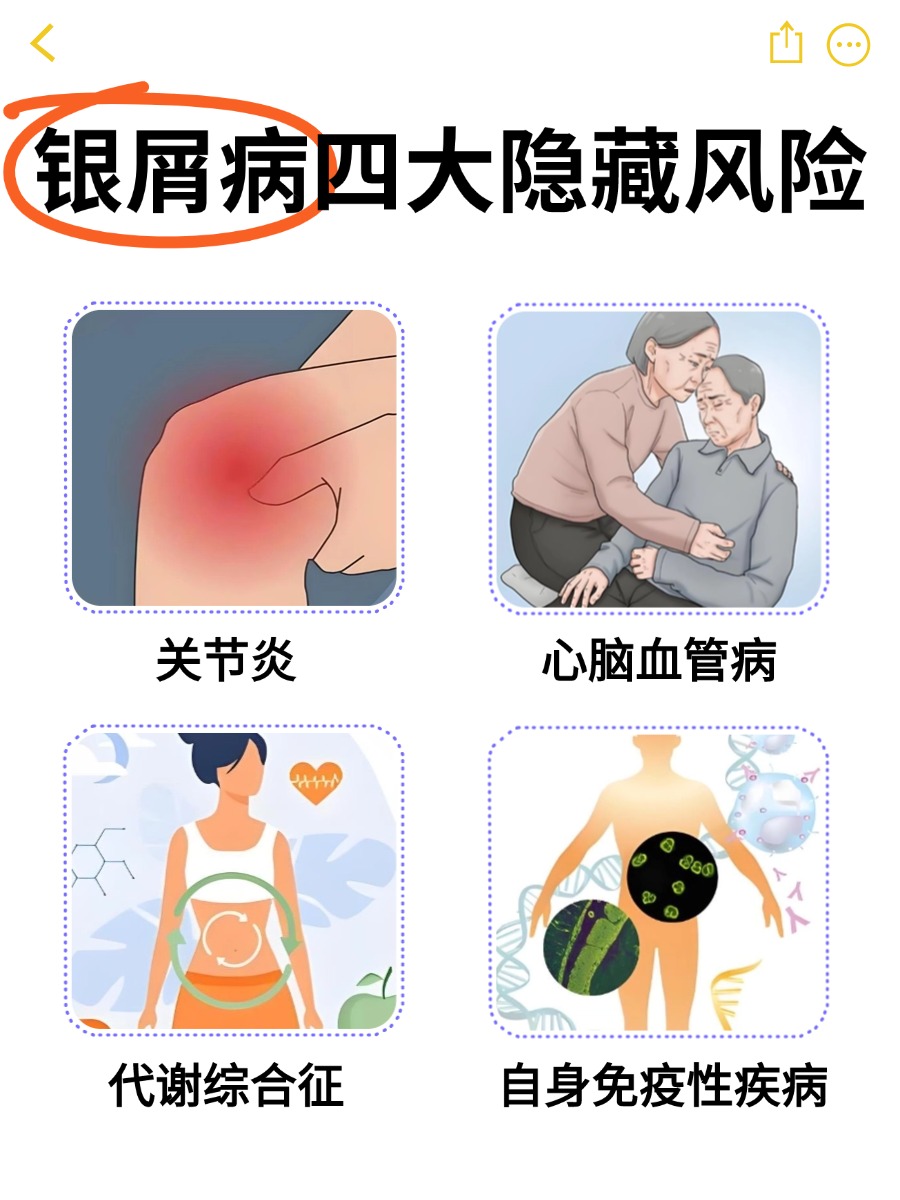 银屑病一般长在什么部位