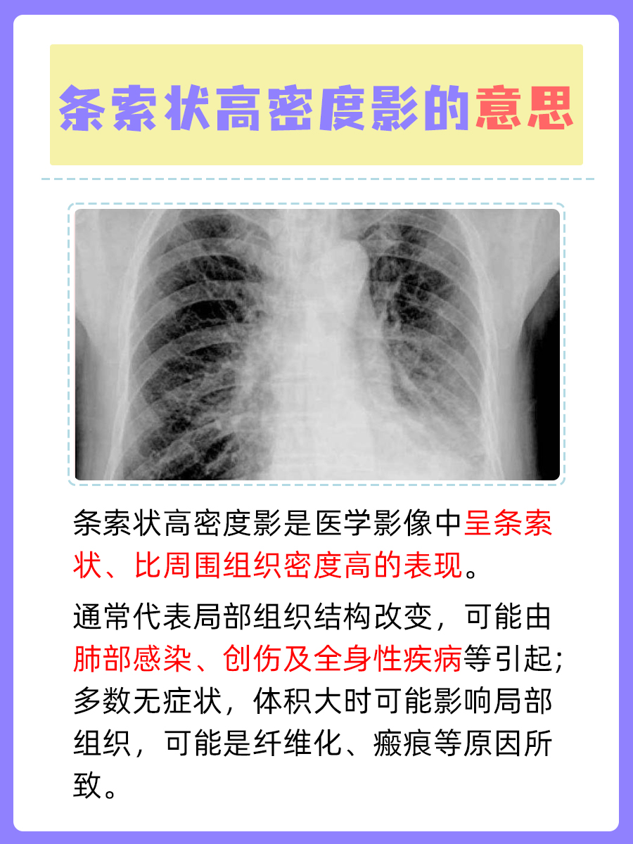 条索状高密度影是什么意思 ？今天带你揭秘