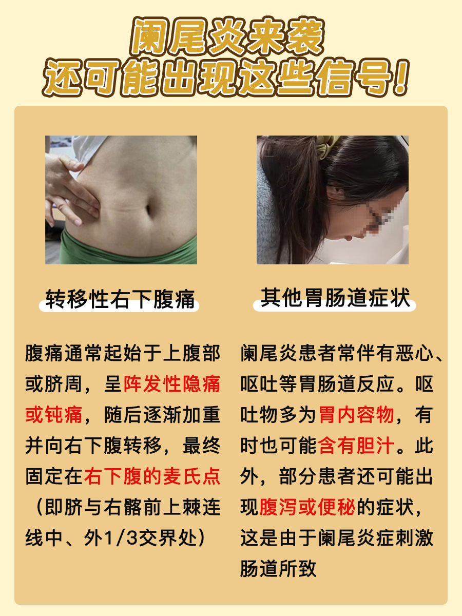 阑尾炎警报！犯困可能是它的信号！