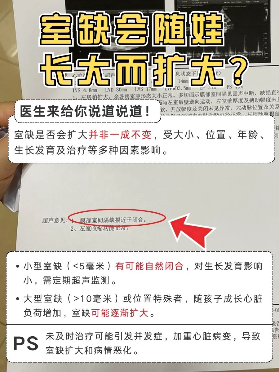 室缺会随娃长大而扩大？医生给你说道说道！