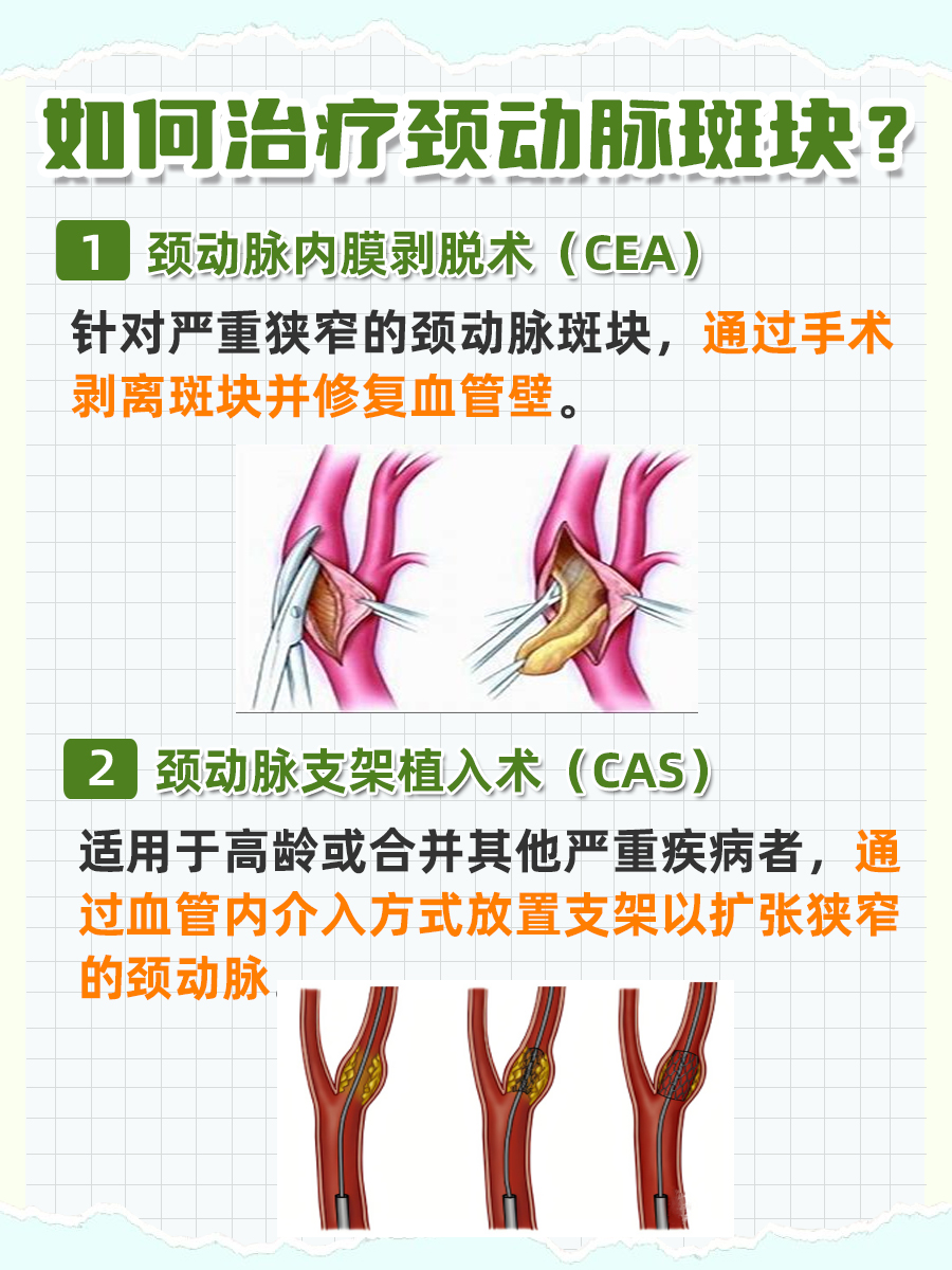 真的有颈动脉斑块最怕的三种水果吗？