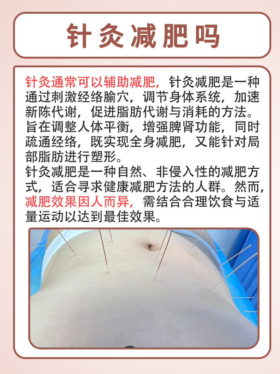 针灸减肥吗？带你了解真相