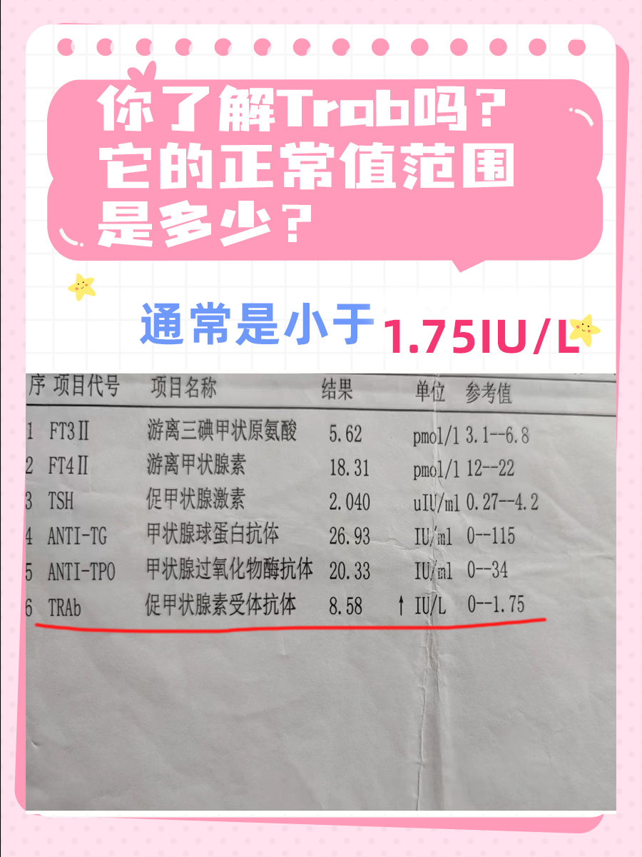 你了解Trab吗？它的正常值范围是多少？