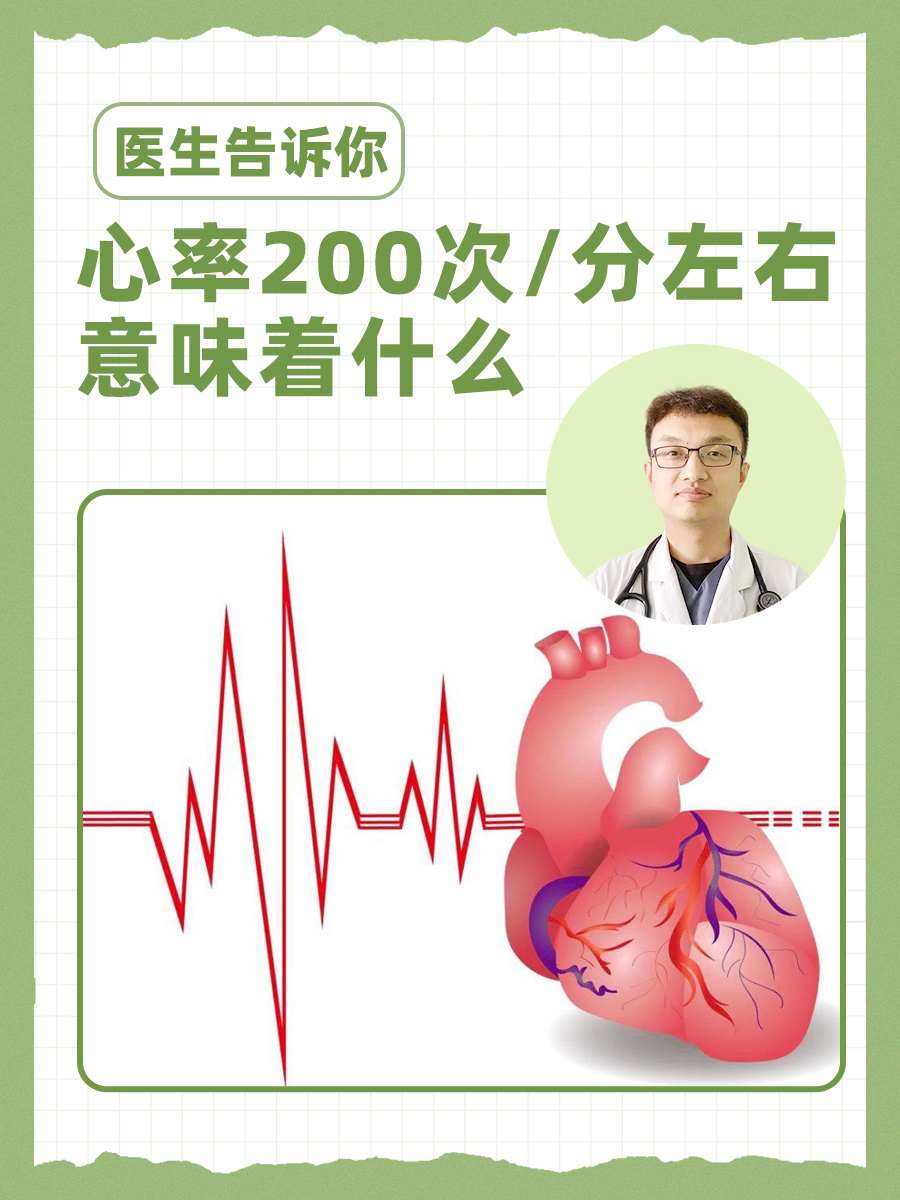 医生告诉你：心率200次/分左右意味着什么