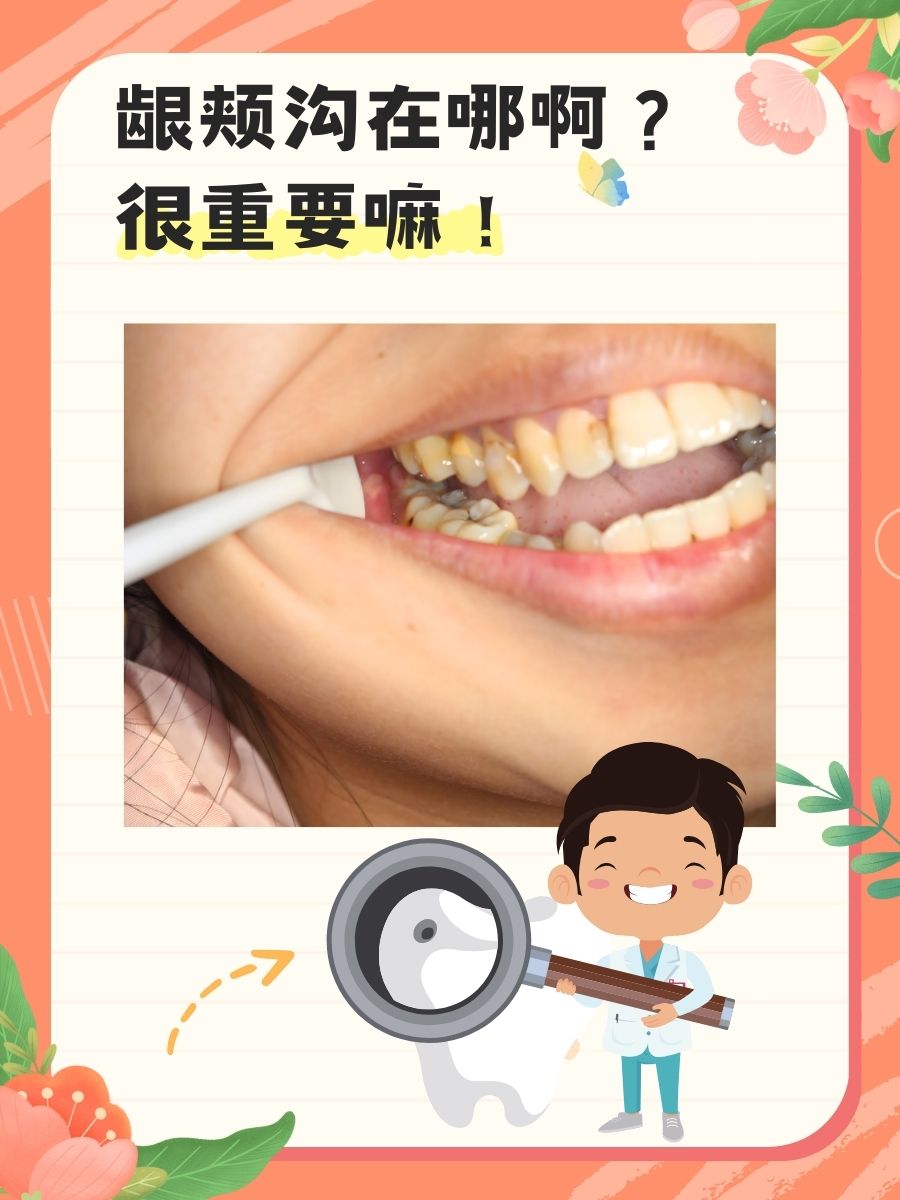 龈颊沟在哪啊？很重要嘛！？