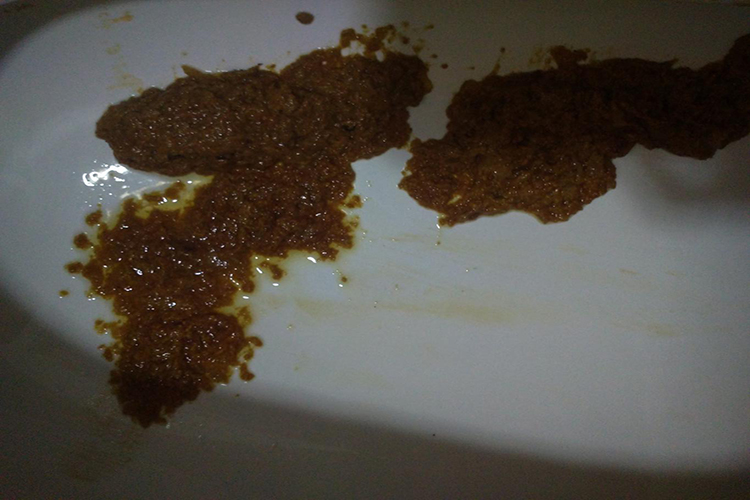 胶原蛋白过敏的腹泻症状图