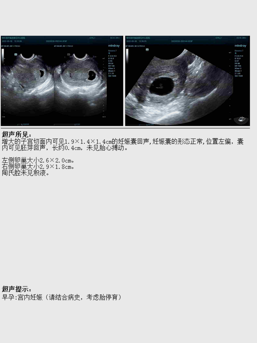 微信图片_20220622173338.jpg