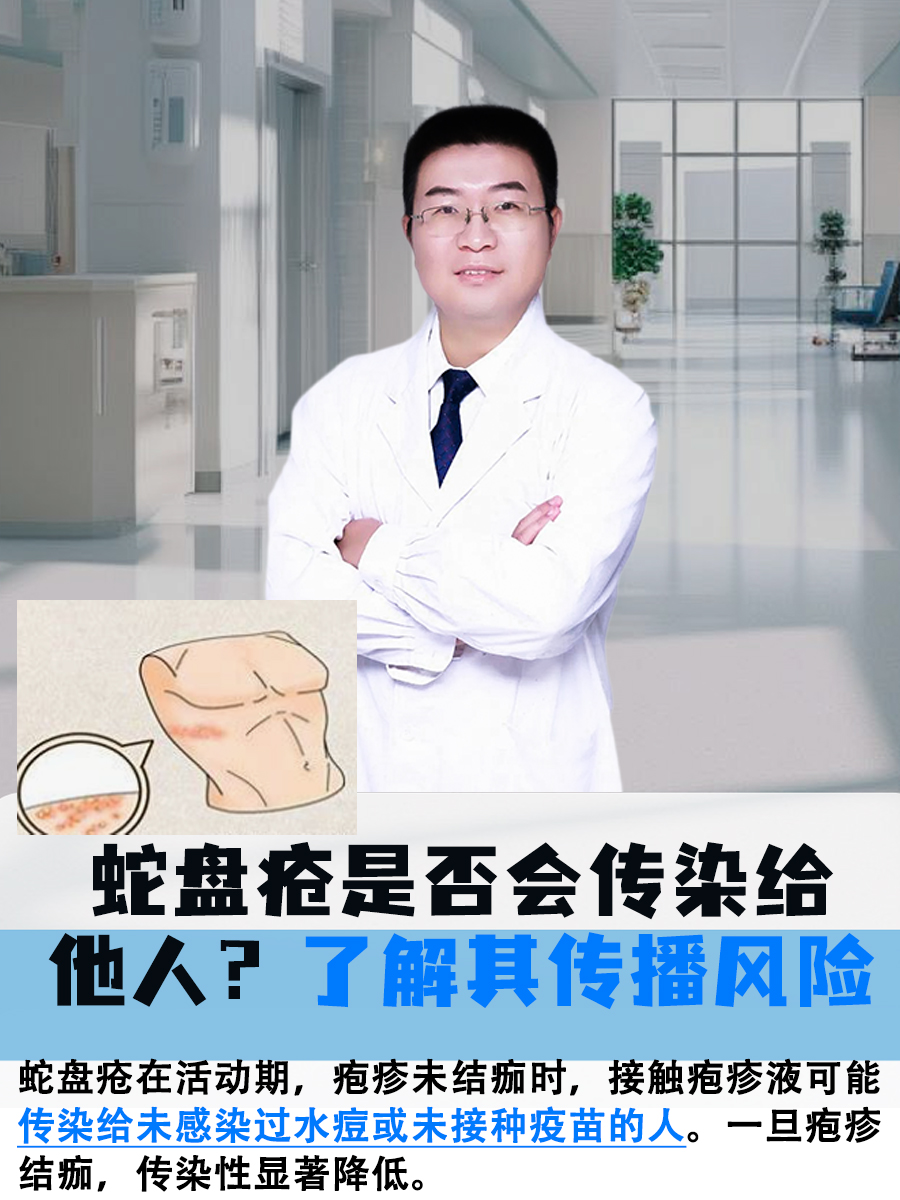 蛇盘疮是否会传染给他人？了解其传播风险