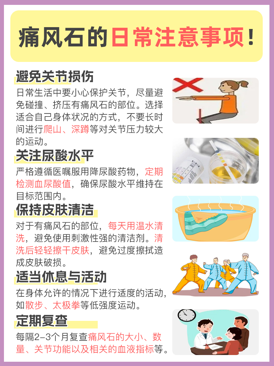 专家告诉你痛风石的消除方法，快来查看