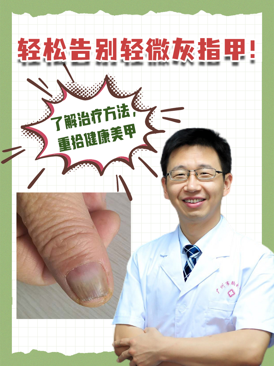 轻松告别轻微灰指甲！了解治疗方法，重拾健康美甲