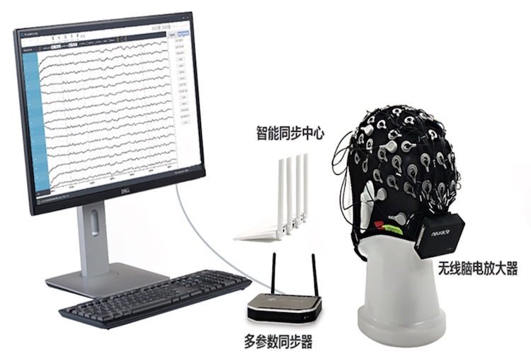 动态脑电图检查图