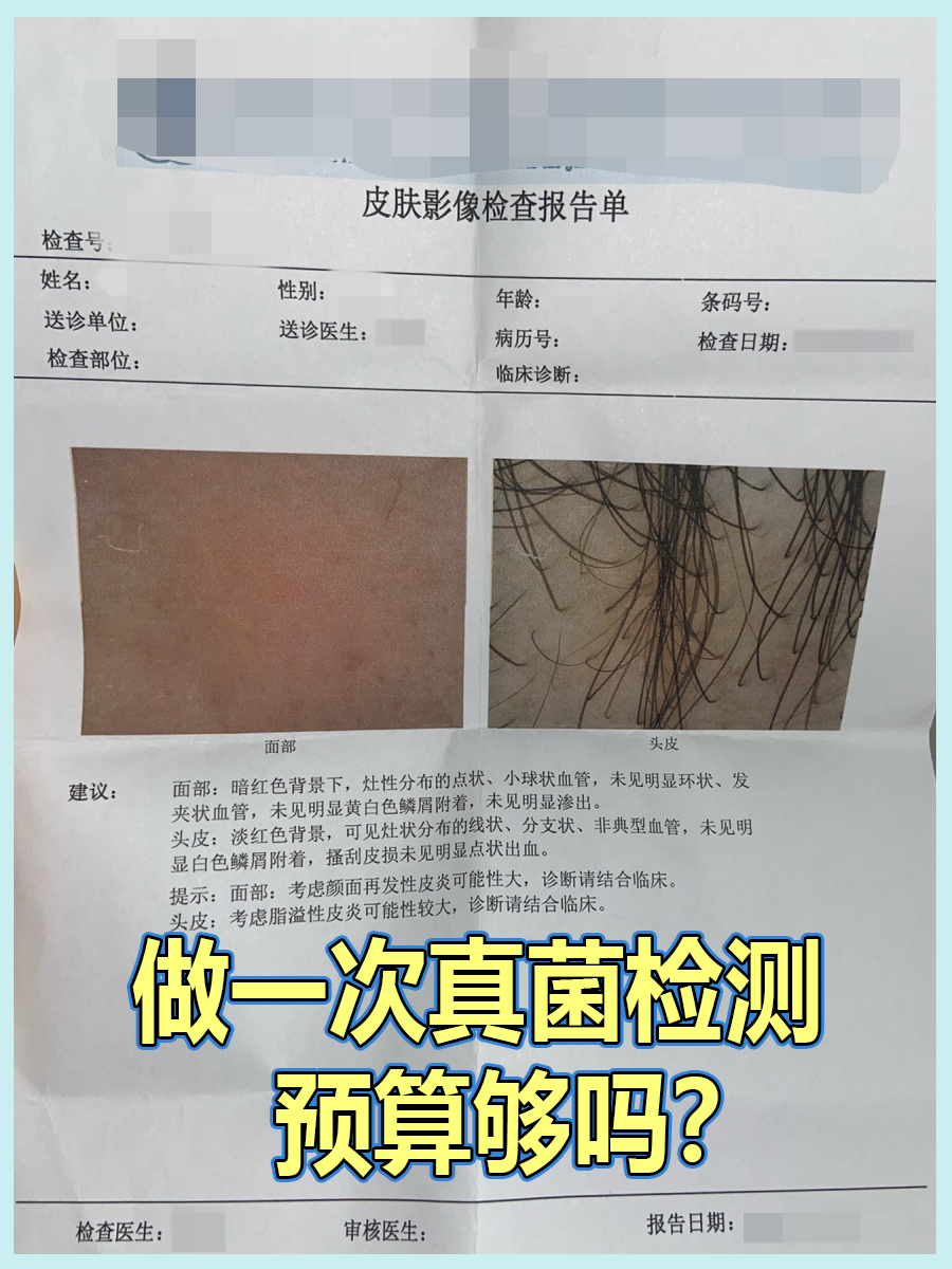做一次真菌检测，预算够吗？