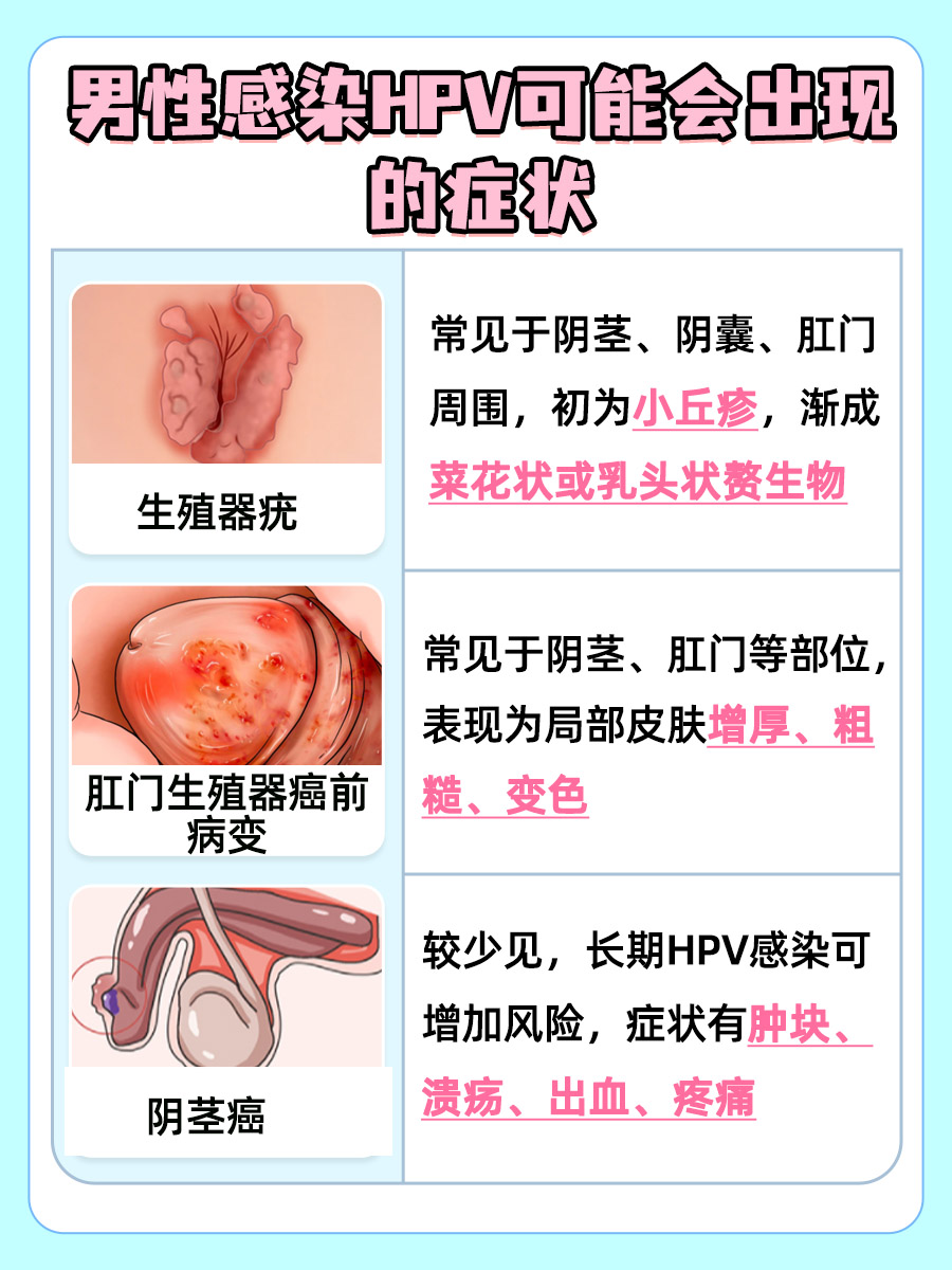hpv图片男性症状图片