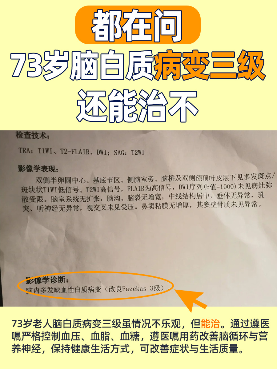 都在问：73岁脑白质病变三级还能治不