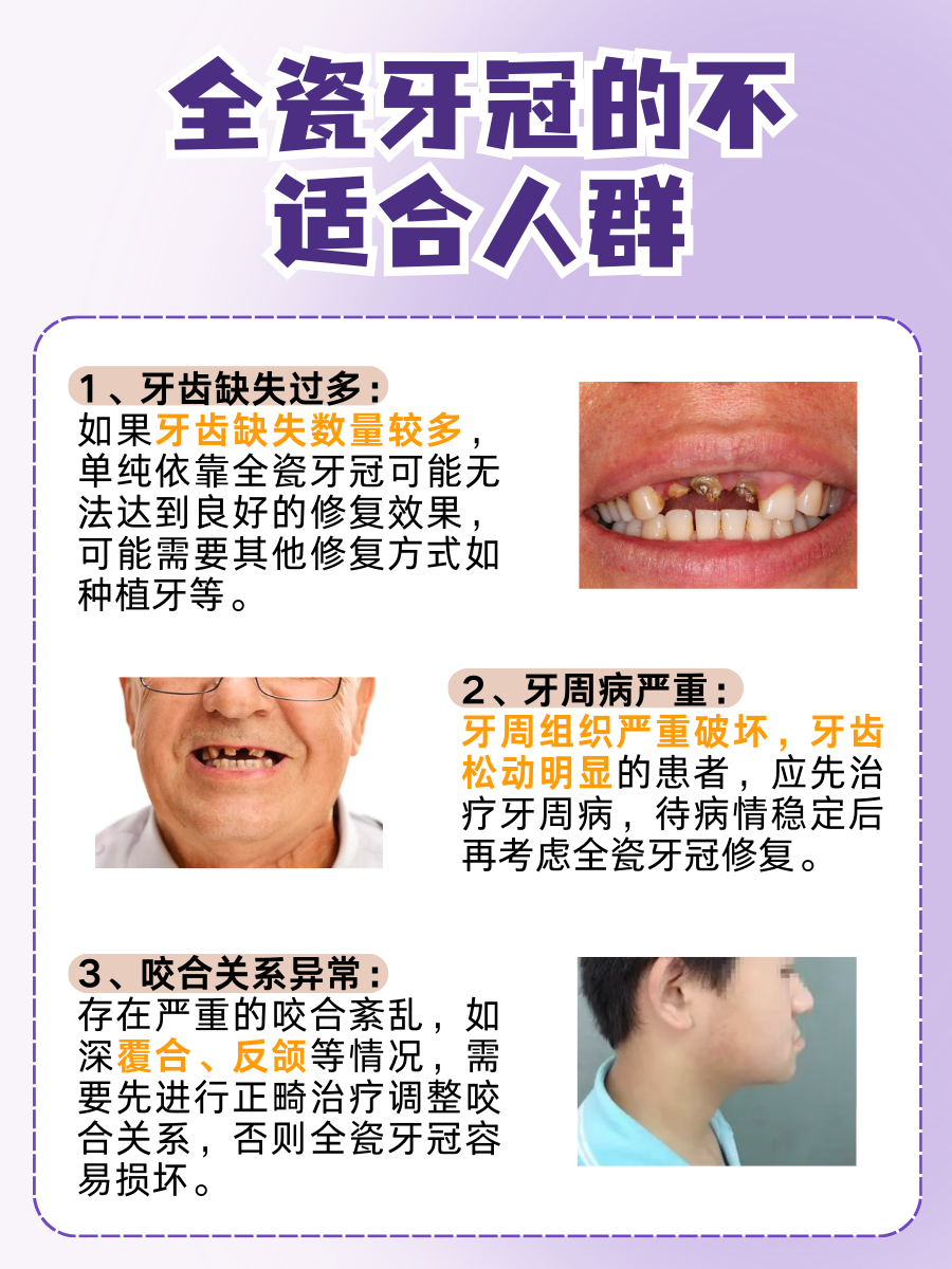 国产VS进口全瓷牙冠区别：差异在哪里？全面解析助你明智选择