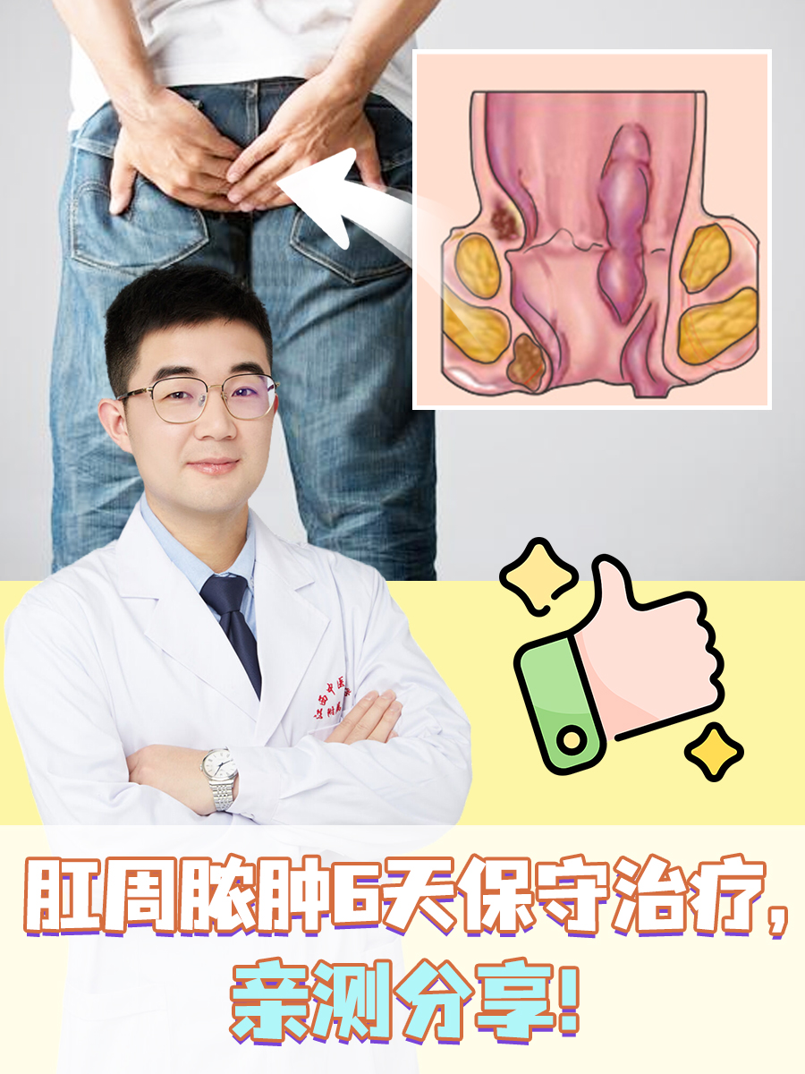 肛周脓肿6天保守治疗,亲测分享!