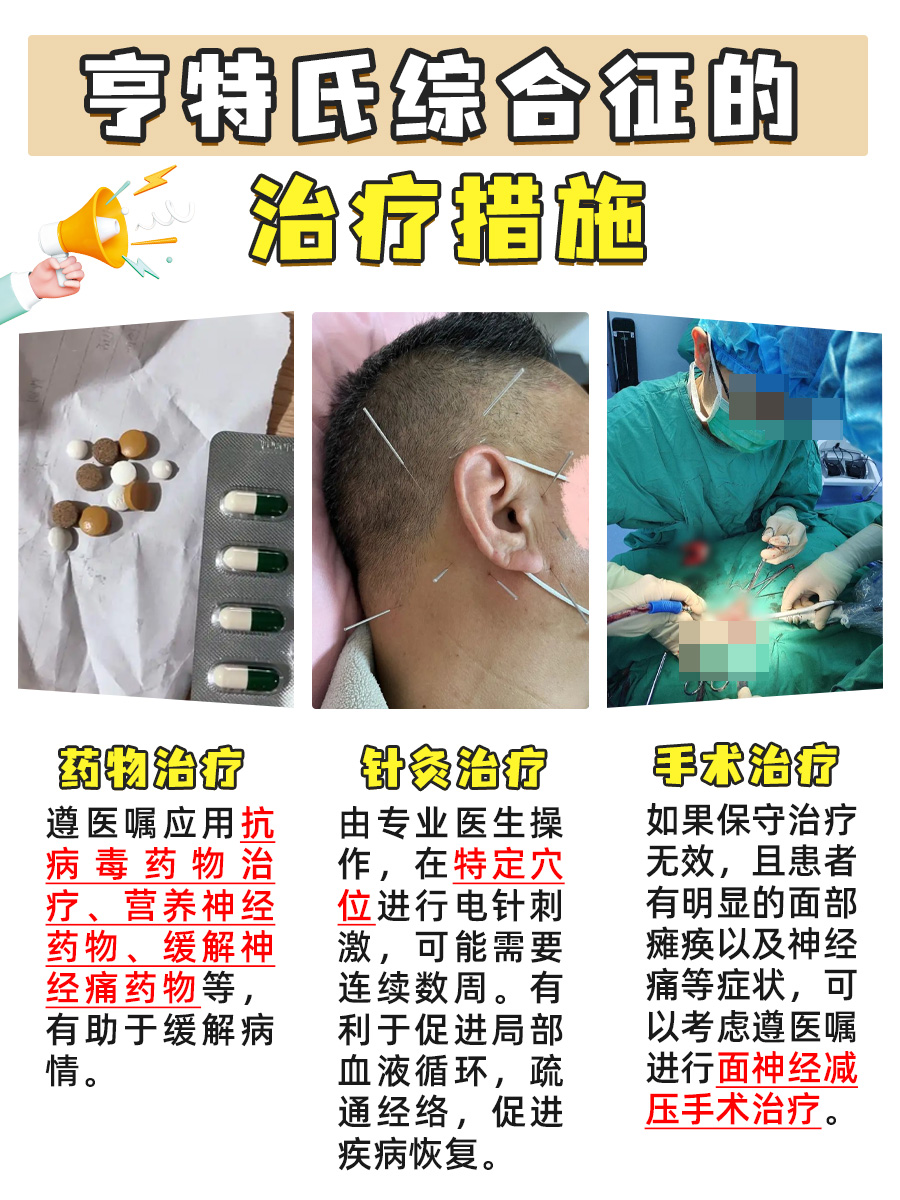 亨特氏综合征：医生不会告诉你的那些小细节！