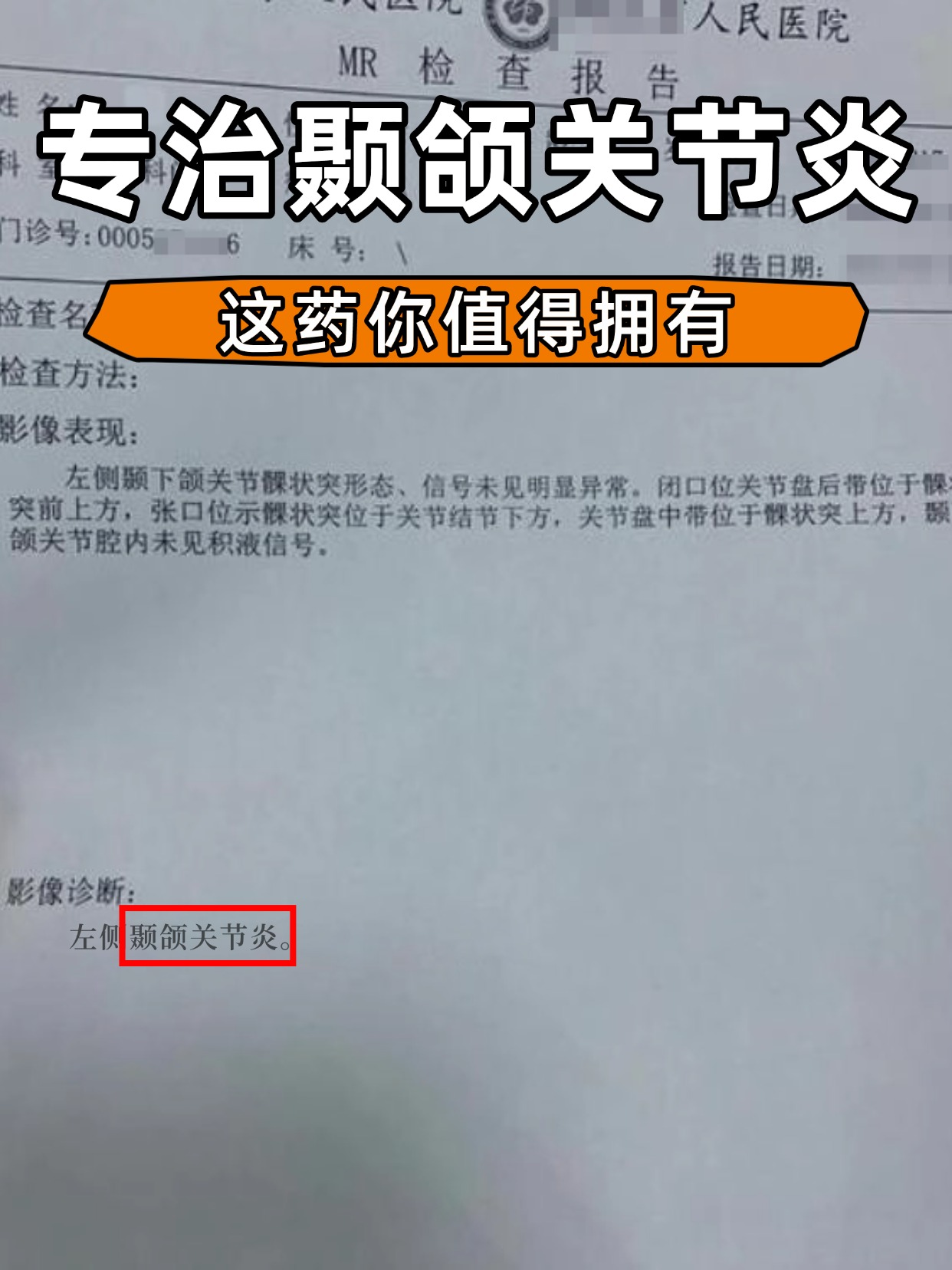 专治颞颌关节炎，这药你值得拥有