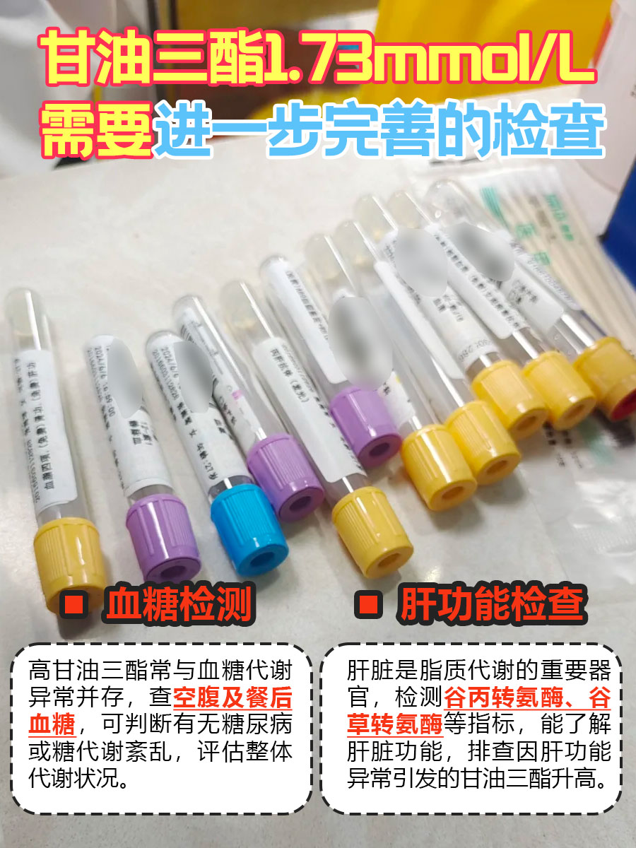 别蒙圈,甘油三酯1.73mmol/L,严重吗