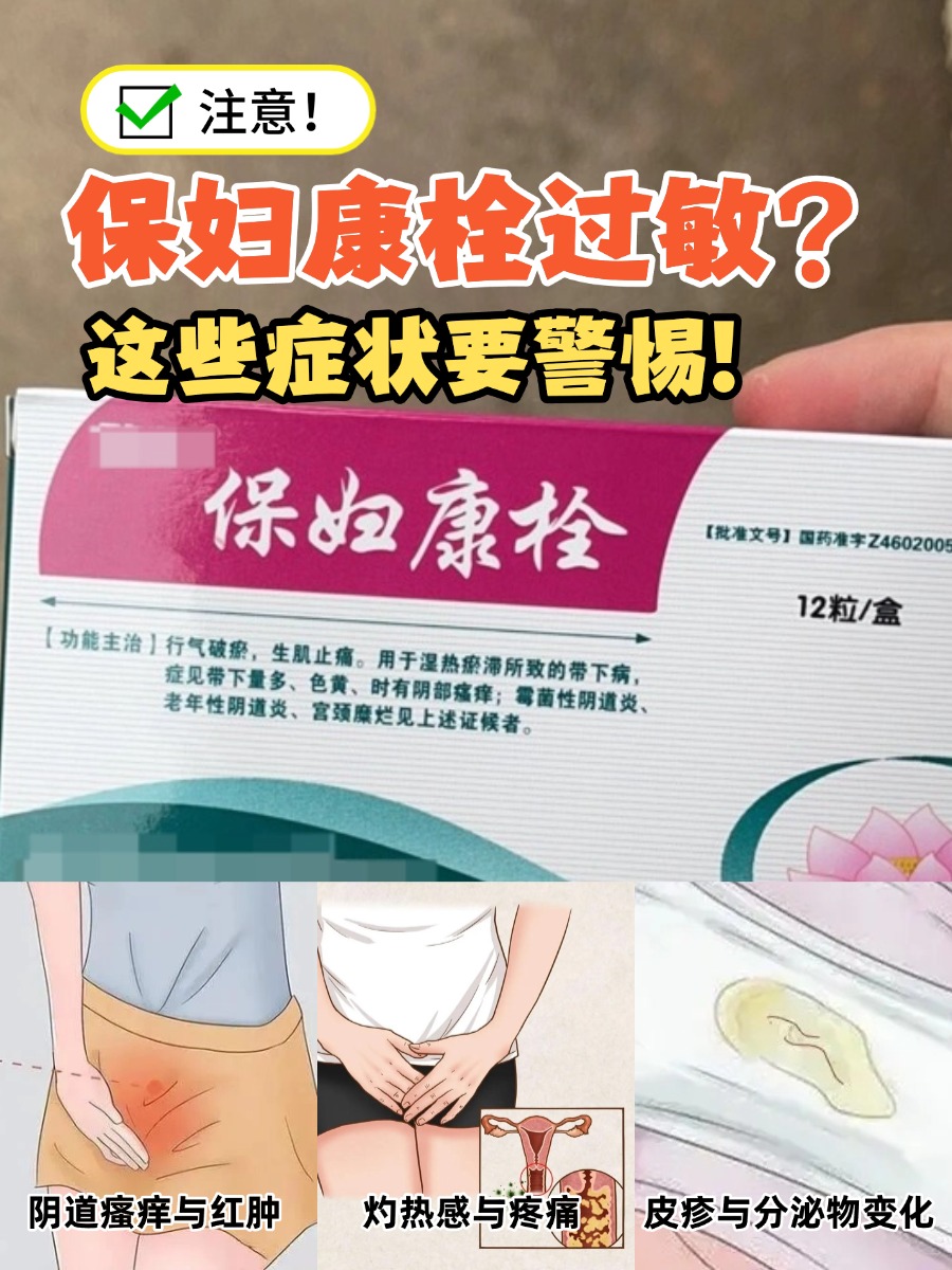 注意！保妇康栓过敏？这些症状要警惕！