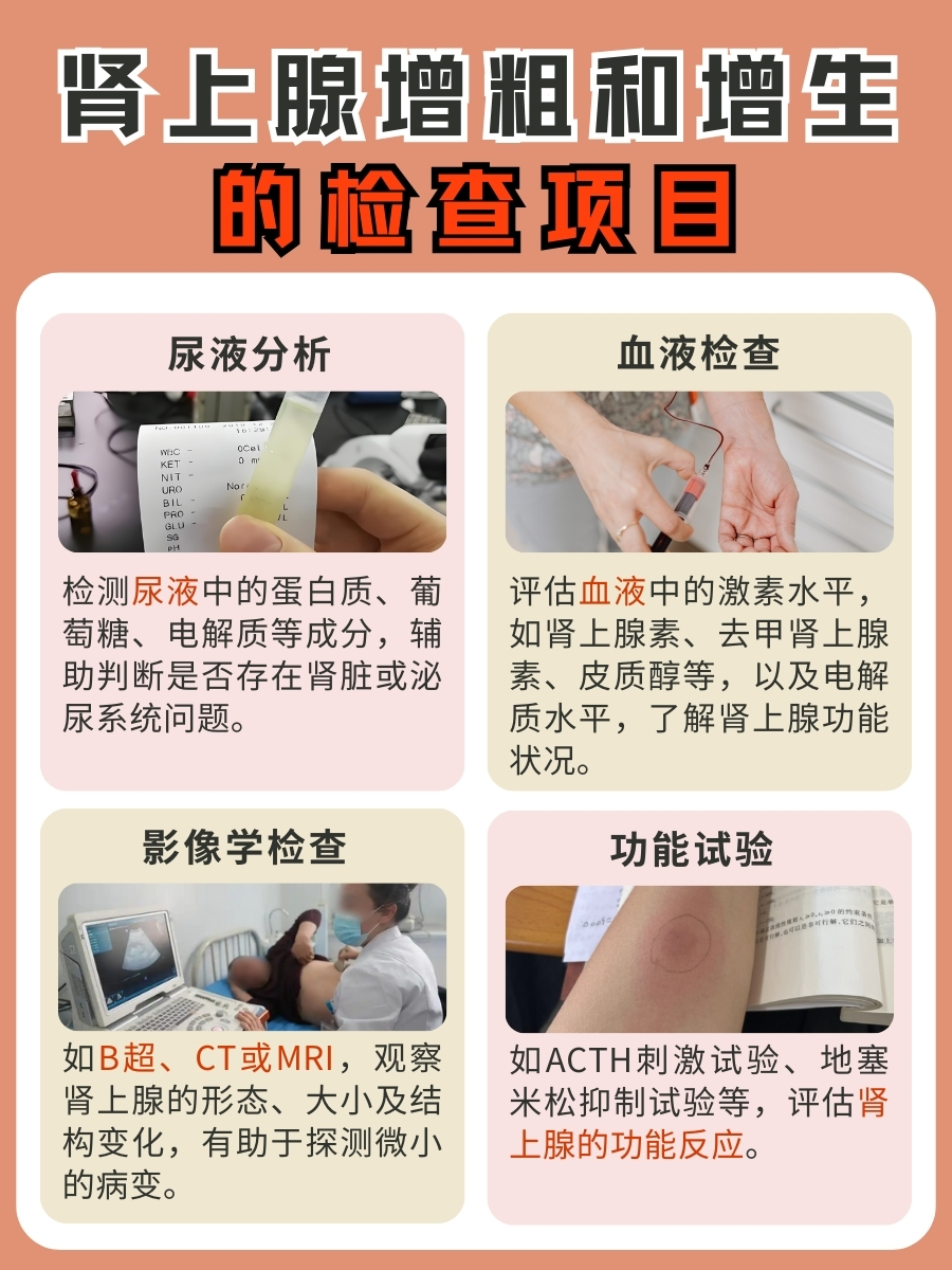 肾上腺增粗VS增生:一文带你了解两者的区别