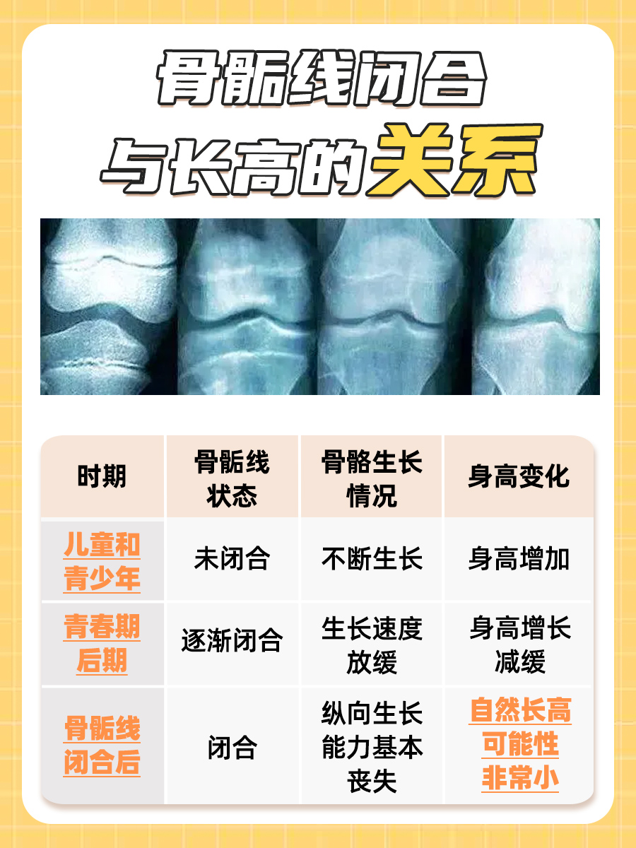 骨骺线闭合还有可能长高吗？一文解析