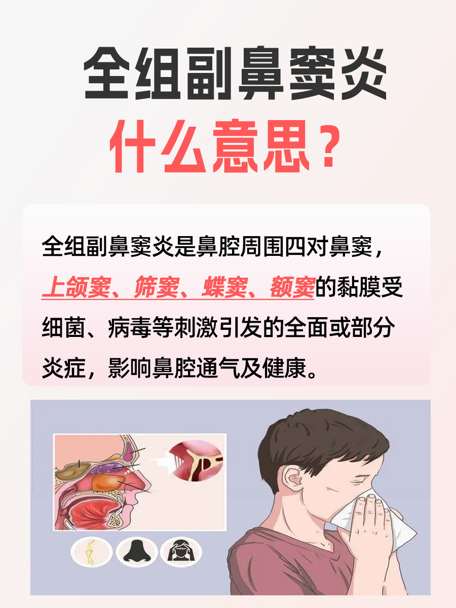 全组副鼻窦炎什么意思，你知道吗？