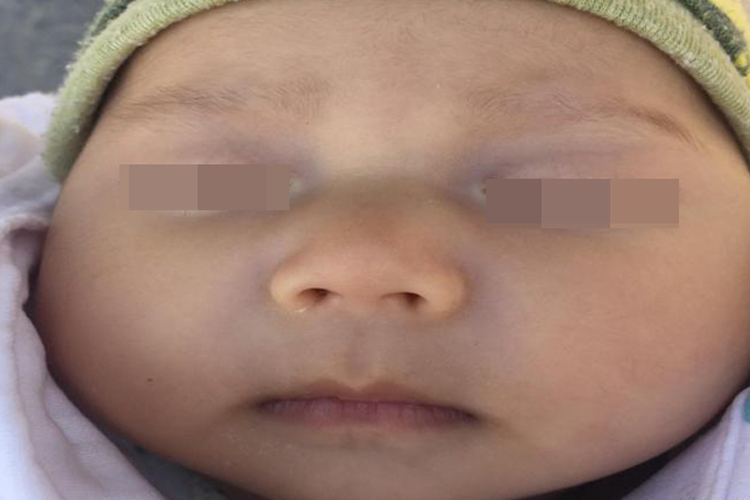 正常口周发青图 正常口周发青图