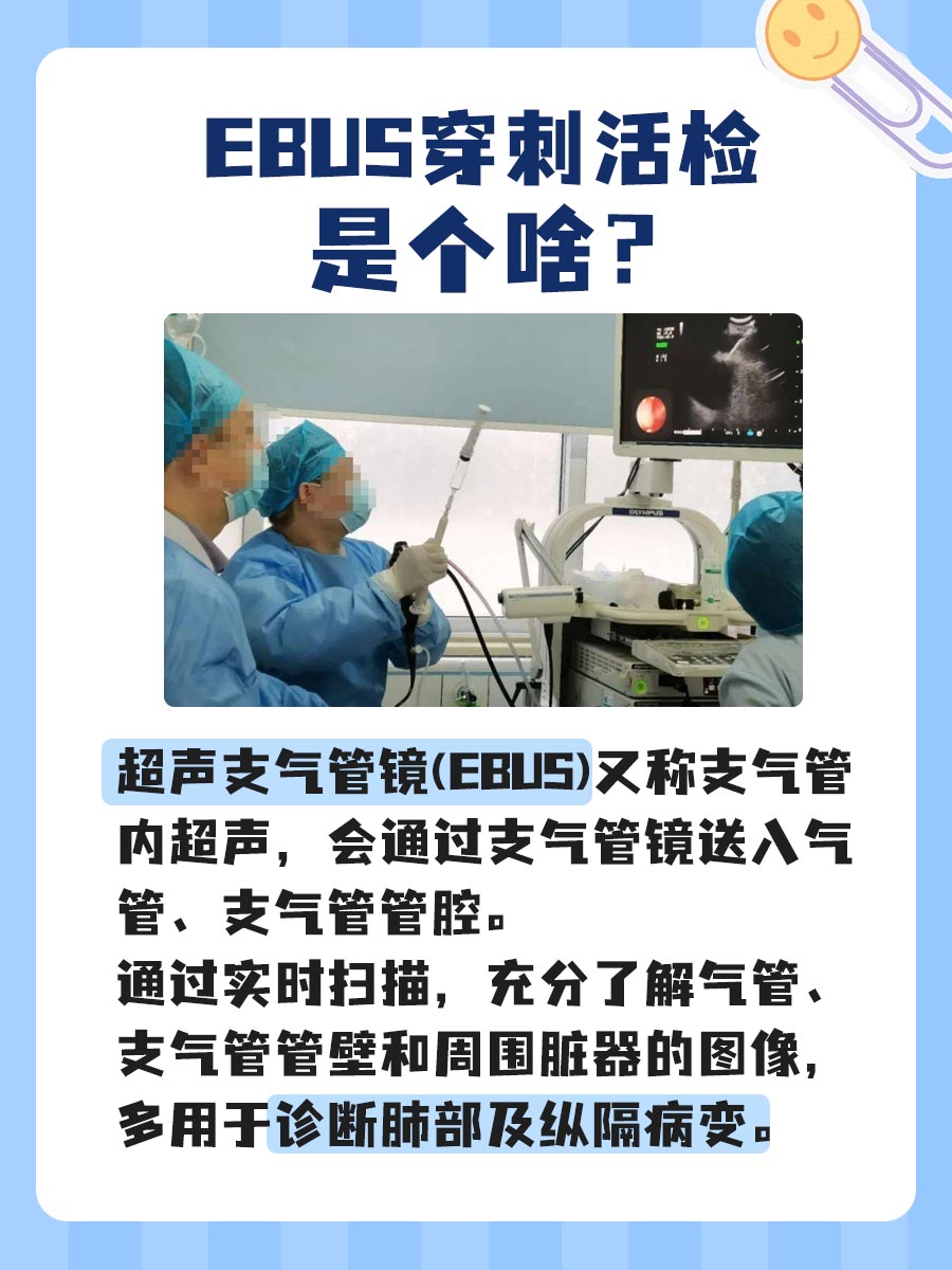 EBUS穿刺活检：它的价格你了解吗？